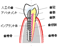 歯根断面図